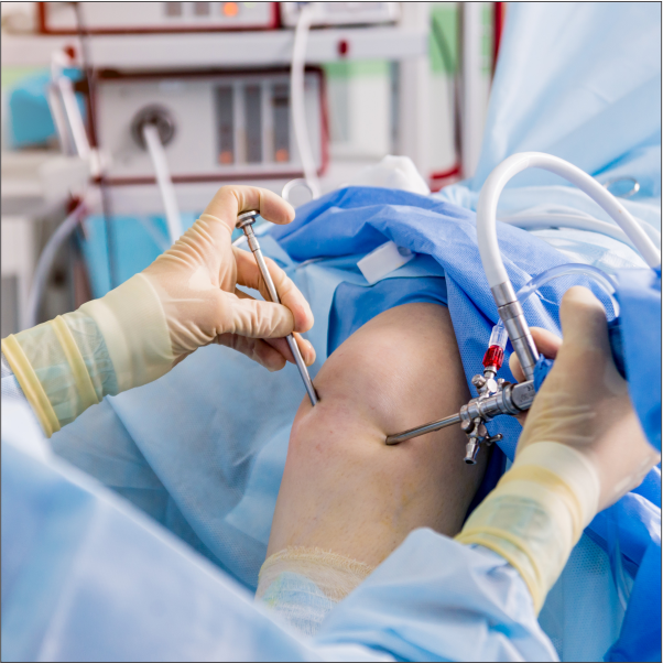 Arthroscopic surgeries 
